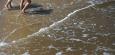 Ostsee: Mensch stirbt an Vibrionen-Infektion