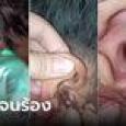 คลิปสยอง นร.นอนติวอยู่ดีๆ ปวดหูมาก เพื่อนส่องเจอแมลงสาบ ช่วยคีบออกมาตัวเป็นๆ
