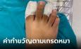 เจ๊โรงน้ำแข็งทำหมาหลุดกัดลูกค้า ขอจ่ายค่ารักษาคนละครึ่ง ลั่น 