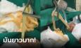 อวสานลาบ-ก้อย-ซอยจุ๊ หมอดึง 