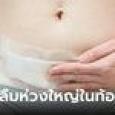 สาวปวดท้องนาน 18 เดือน ที่แท้หมอลืม 