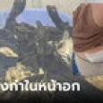 ขนลุก สาวผ่านด่านตรวจท่าทางพิรุธ เสื้อหลวมแปลกๆ ค้นเจอกิ้งก่าเป็นๆ ในยกทรง 16 ตัว