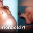 หมอขนลุก ผ่าท้องผู้ชายแท้ๆ เจอศพ 