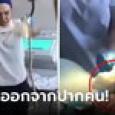 ยาวเป็นเมตร! หมอดึงงูออกจากปากคนไข้ พยาบาลตัวสั่นหน้าถอดสี รู้ว่าเข้าไปได้ไงยิ่งสยอง