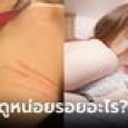แม่สาวคนดัง โพสต์ภาพรอยแผล ถาม 