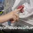 แม่ป่วยเนื้องอกตอนตั้งท้อง บอกลาลูกในตู้อบ ก่อนสิ้นลมยังบริจาคอวัยวะช่วยคนอื่น